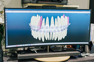 歯科用CTシステム（3Dデジタルレントゲン）