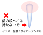 抜けた歯の上の部分をもつ