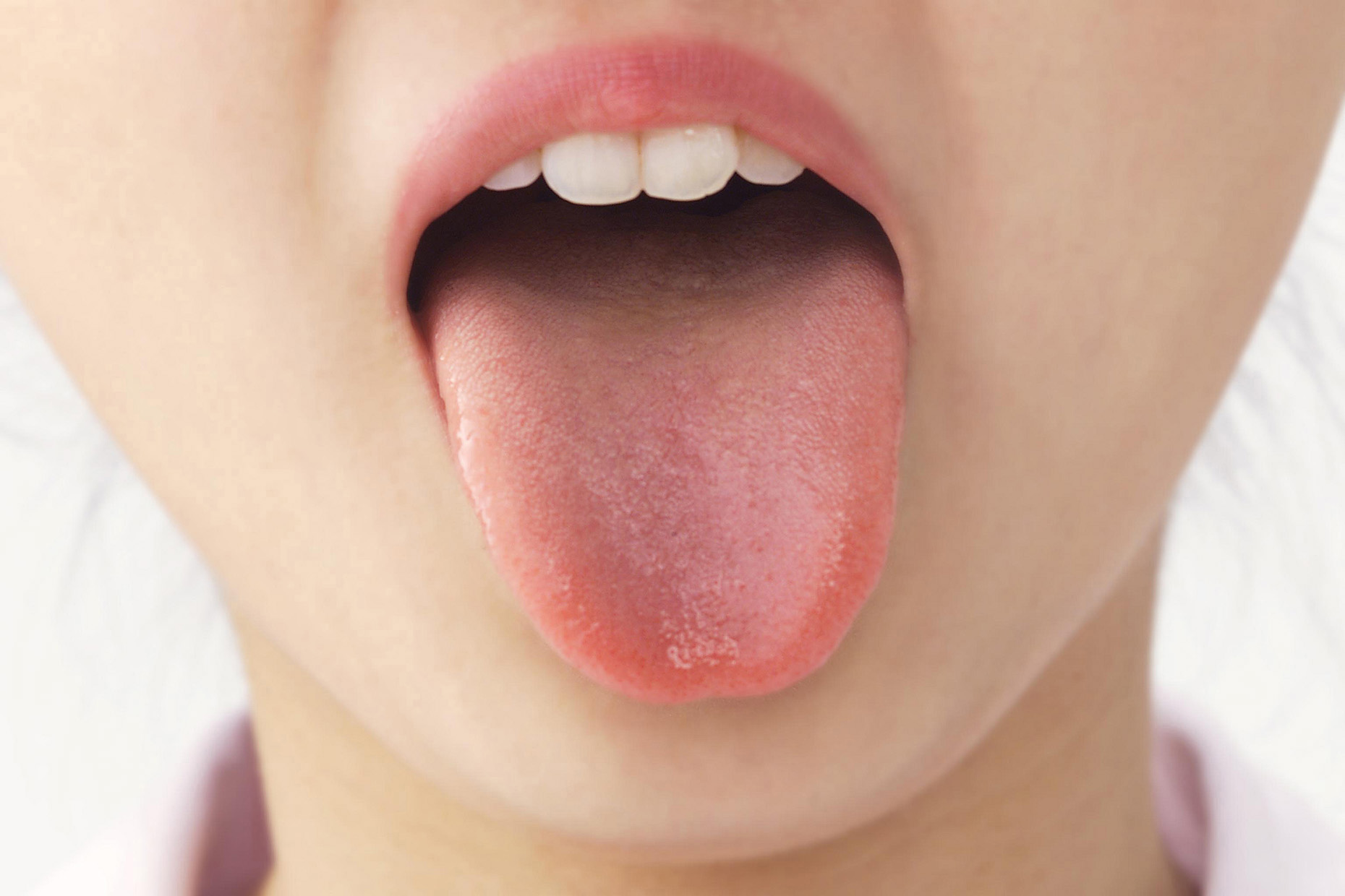 舌を出す(舌癖)